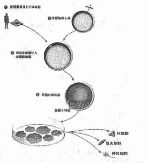 克隆技术视角下的人体干细胞开发与应用